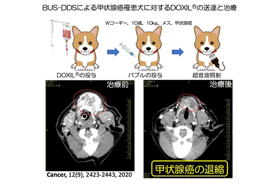 BUS-DDS甲状腺癌DOXIL