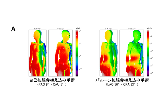 図1A：心エコー医の放射線被ばく線量のシミュレーション結果