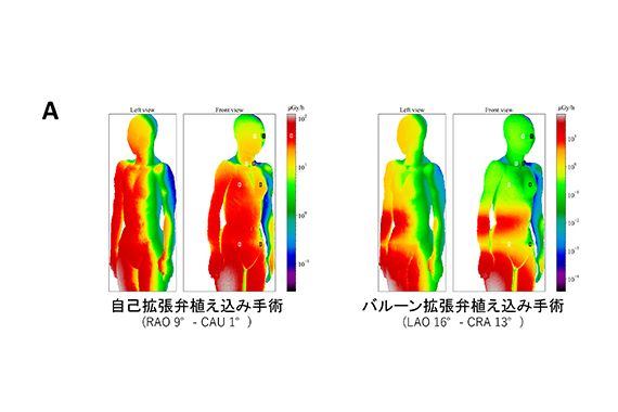 Figure 1A: Simulated radiation dose for echocardiologists