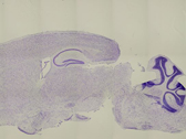 Creation of new technologies for diagnosis and treatment based on epigenome research