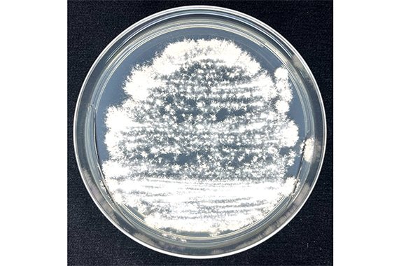 山田准教授らの国際研究グループが、白癬菌（水虫）の薬剤耐性を上昇させる遺伝子発現の仕組みを発見しました