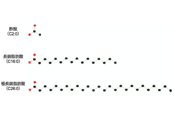 濱准教授らの研究グループが指定難病「副腎白質ジストロフィー」診断の鍵となるマーカー分子の産生酵素を発見しました