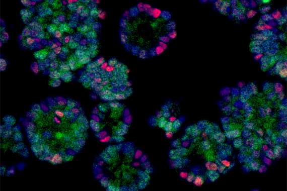 先端総合研究機構の岡本教授らの研究グループが、がん細胞の抗がん剤抵抗性を担う分子メカニズムを解明しました