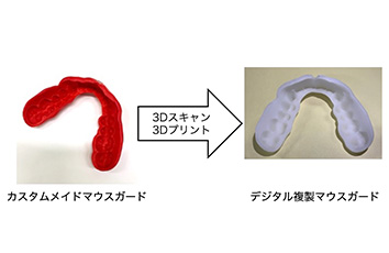 3D計測・3Dプリンティングによるスポーツ用マウスガードのデジタルレプリケーション