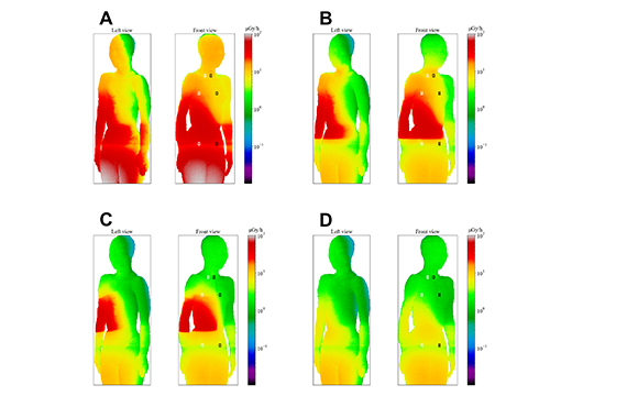 Figure 2: Anesthesiology Radiation Exposure Dose