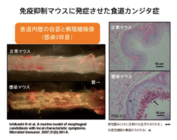 免疫抑制マウスに発症させた食道カンジダ症