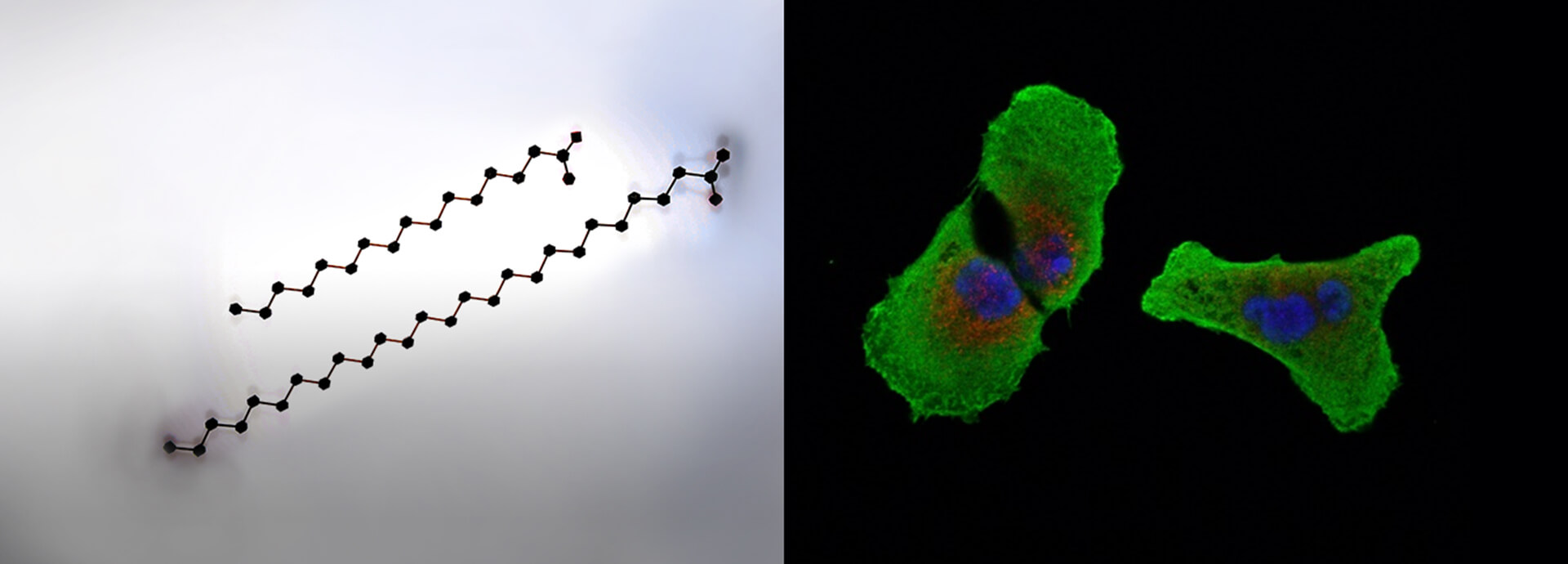 Elucidating the relationship between lipid metabolic processes and diseases