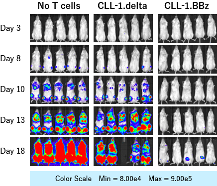 Image of suppression of AML cell growth by CLL-1 CAR-T cells