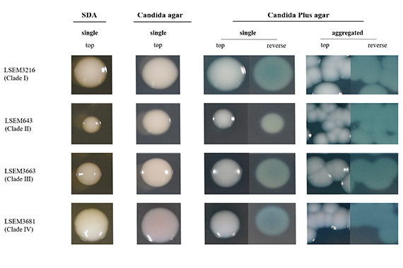 We have discovered a quick and easy method for detecting and identifying Candida auris strains using a new medium.