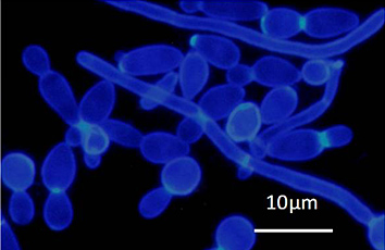 同一プレパラートのカルコフローラ・ホワイト染色像。カンジダ菌の細胞壁を構成するb-グルカンのみが青白く染色されています。