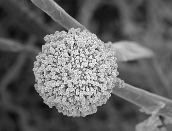 Aspergillus niger の走査型電子顕微鏡像