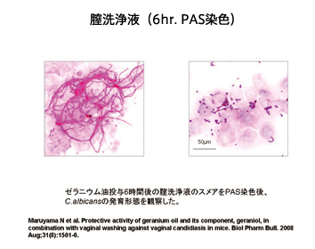 膣カンジダ症マウスに植物精油を投与するとCandida albicansが酵母型となる