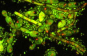 FUN1染色像。菌糸形発育したカンジダ菌の周囲を細かい粒子状の乳酸菌が取り囲んでいます。